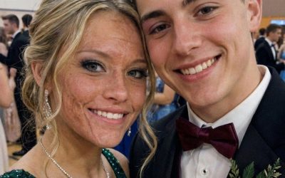 A Boy Asked Me to Dance at Prom Because No One Else Would Due to My Scars – The Next Day, His Parents and Officers Showed up at My Door