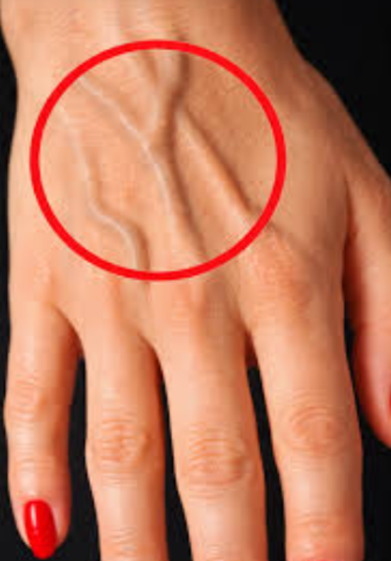 If you have visible veins, it means you are…