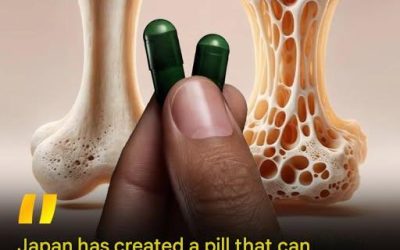 A Daily Pill That Could Rebuild Bone? New Research Offers Hope for Osteoporosis
