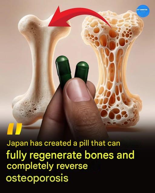 A Daily Pill That Could Rebuild Bone? New Research Offers Hope for Osteoporosis